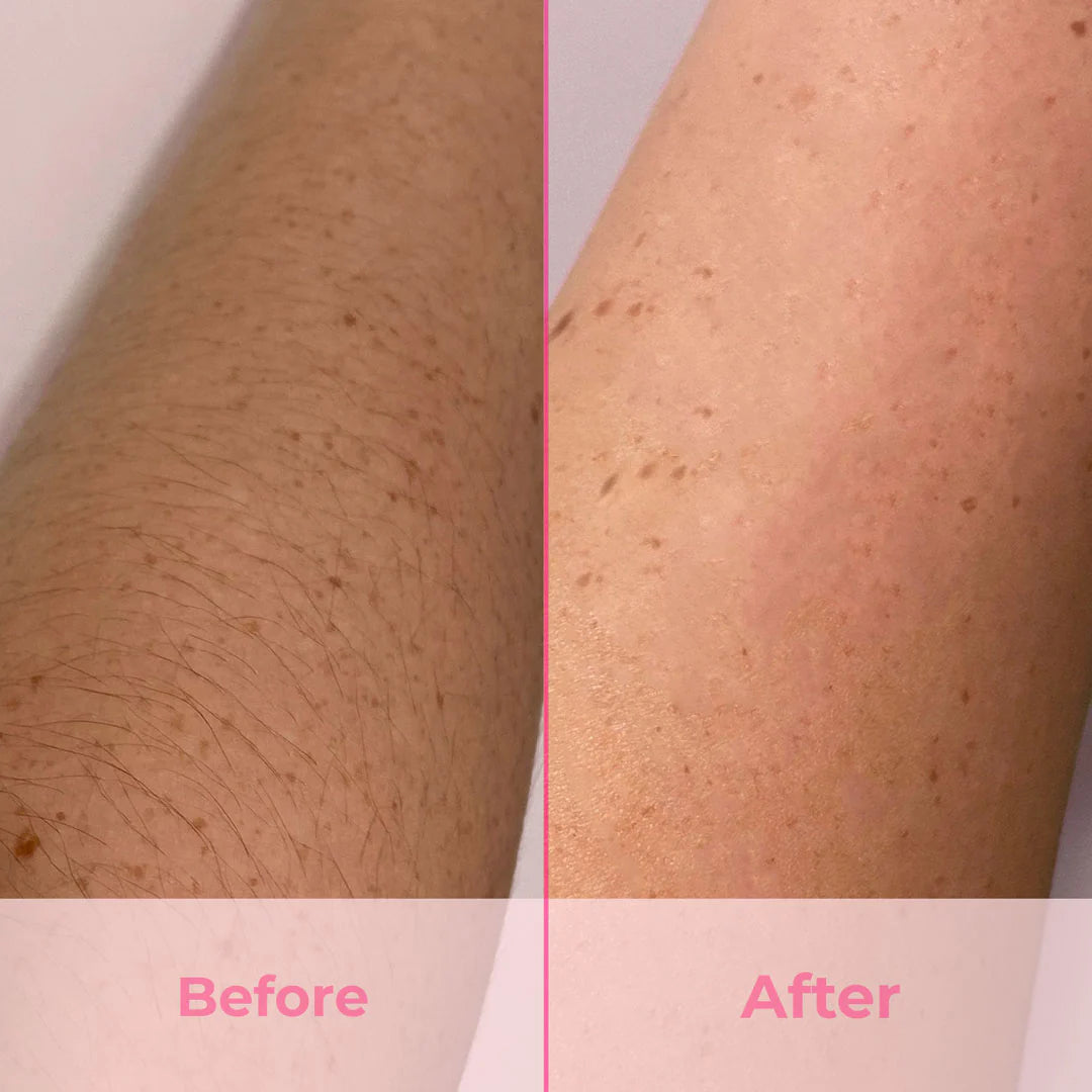 NovaSilk SmoothSkin IPL